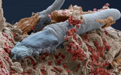 Τα Ακάρεα που Ζουν στο Πρόσωπό Μας