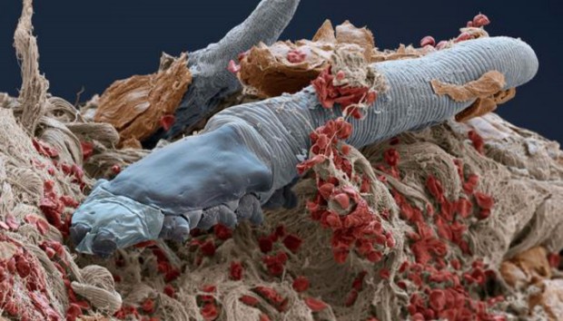 Τα Ακάρεα που Ζουν στο Πρόσωπό Μας